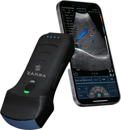 Ecografo Wireles 3 en 1 Multitraductor con celular